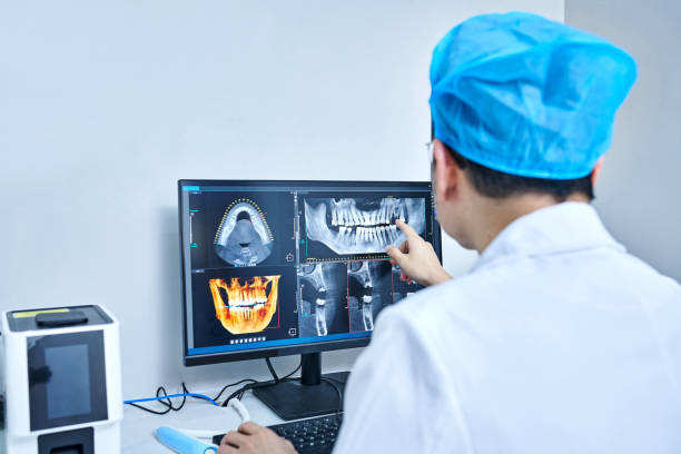 Best Emergency Wisdom Tooth Extraction in Lmdale, PA
