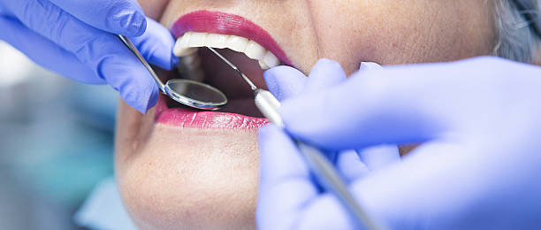 Best Emergency Root Canal Therapy in Lmdale, PA